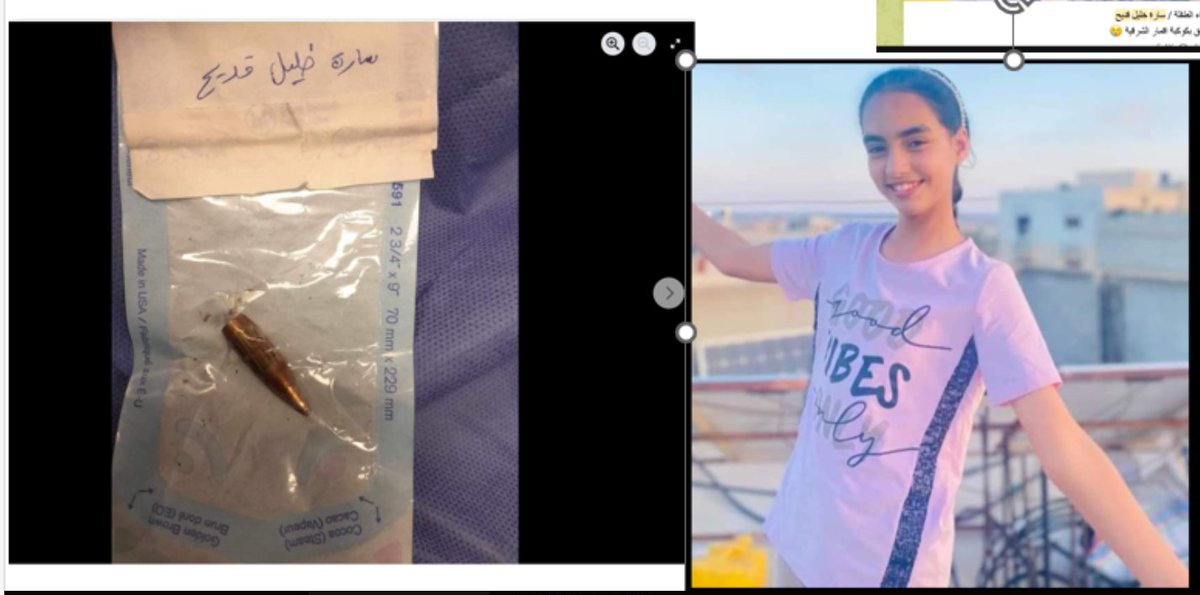 One of the case studies I'm mentioning in my AOAV piece debunking charlatans <a href="/Aizenberg55/">Aizenberg</a>/<a href="/Mr_Andrew_Fox/">Andrew Fox</a>  is this 10-year old girl (pic related), Sara, who was directly shot in the head by an IDF drone. Aizenberg posted her ID as an example of a 'fake death', but Sara in fact