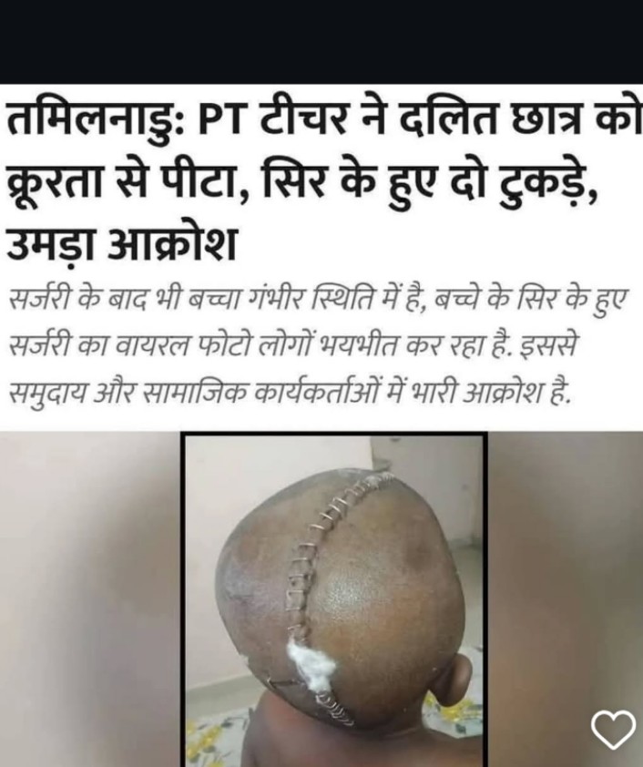 जितना हम सहते है उसका 1% भी सहन करके दिखाओ तब बोलना कि दलितों का आरक्षण खत्म करो।