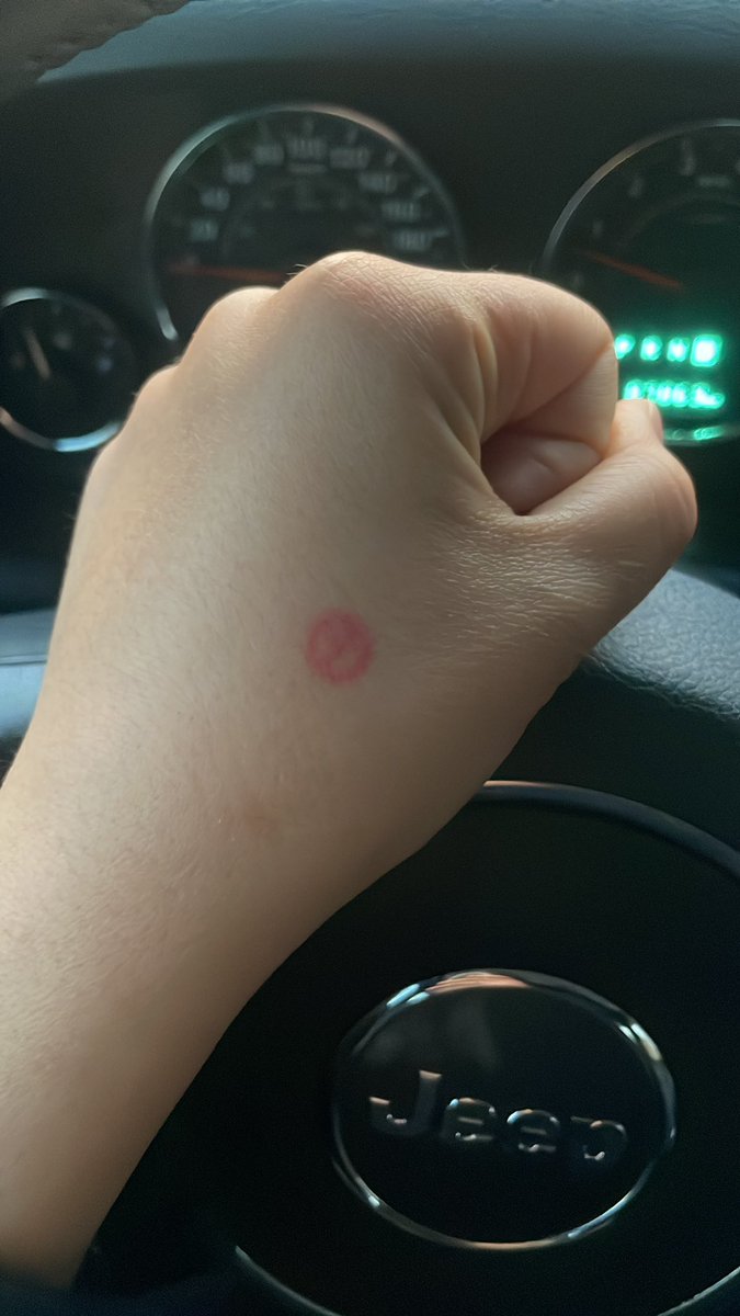 아마두 우리 동네 마지막 투표자