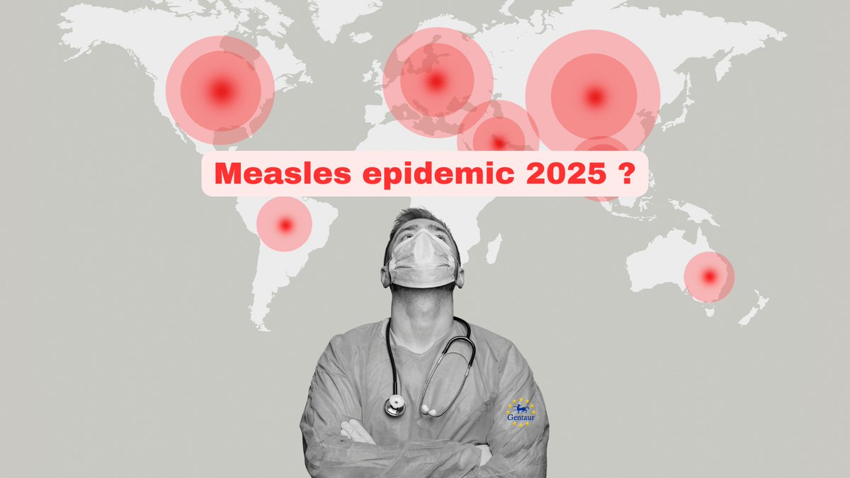 🚨 Epidemia odry 2025: Ponad 1000 przypadków w USA, głównie niezaszczepieni. Bardzo zakaźny wirus globalnie. Szczepienia są kluczowe! Gentaur wspiera badania zestawami PCR do szybkiego wykrywania.
Źródła: CDC &amp; WHO
#Odra2025 #Szczepienia #Gentaur