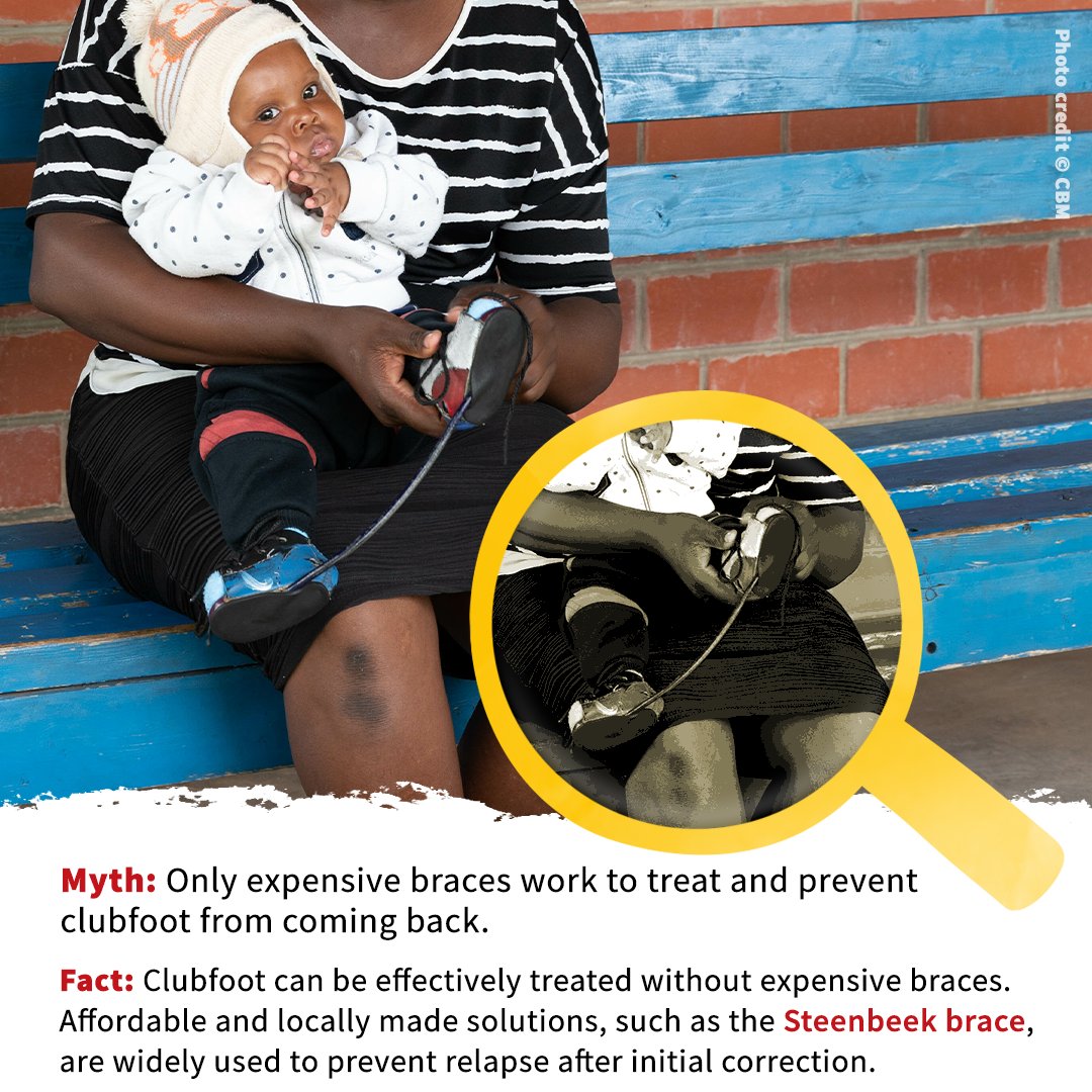 Against common belief, treating clubfoot doesn't require expensive braces.
In many low- and middle-income countries, affordable solutions like the Steenbeek brace help children walk confidently. Proving that effective care can be both accessible and affordable
#ClubfootAwareness
