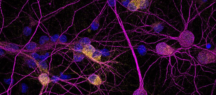 CIBER_ISCIII's tweet image. 👥Grupos CIBERNED logran un avance significativo en la comprensión de los mecanismos moleculares implicados en la enfermedad de Huntington 

➡️ciberisciii.es/noticias/ident…

#CIBER #investigacion