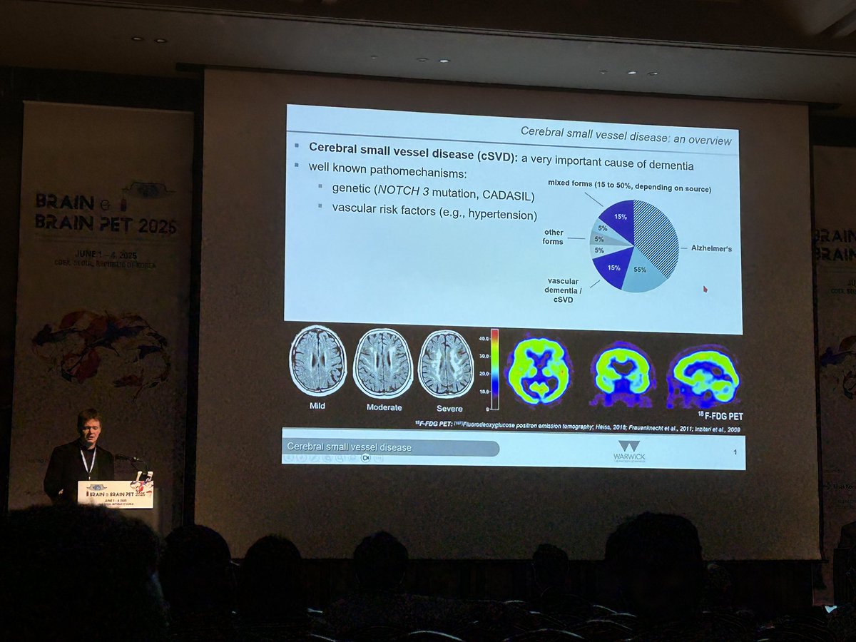 JCBFM (@_jcbfm) on Twitter photo 🧠 At the JCBFM Symposia, Guest Editor Johannes Boltze introduced a future special issue on Advances in Small Vessel Disease Research.
🧬 Follow us for more details! #SmallVesselDisease #Neuroscience <a href="/BRAINPET25/">Brain and Brain PET 2025</a> #ISCBFM 🧠 At the JCBFM Symposia, Guest Editor Johannes Boltze introduced a future special issue on Advances in Small Vessel Disease Research.
🧬 Follow us for more details! #SmallVesselDisease #Neuroscience <a href="/BRAINPET25/">Brain and Brain PET 2025</a> #ISCBFM