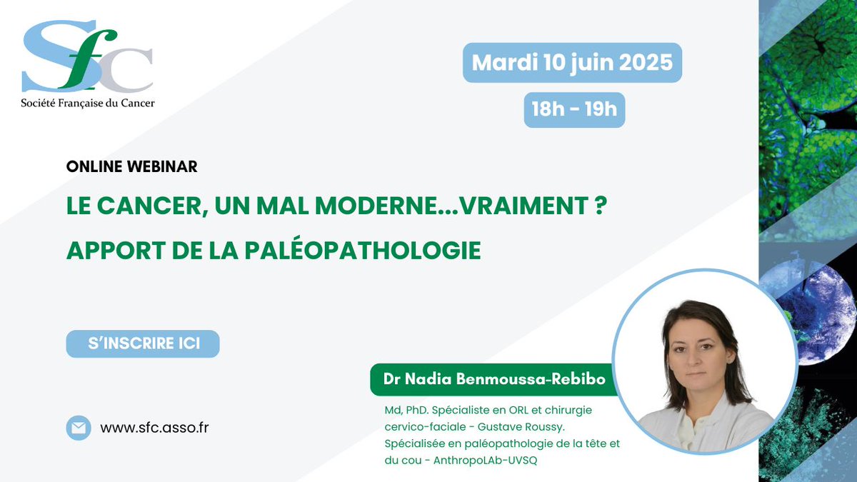 Vous pouvez vous inscrire au prochain Webinaire de la SFC du mardi 10/06/2025 à 18h : "Le cancer, un mal moderne...vraiment ? Apport de la paléopathologie" par Nadia BENMOUSSA-REBIBO, Md, PhD Spécialiste en ORL et chirurgie cervico-faciale, IGR : us02web.zoom.us/webinar/regist…