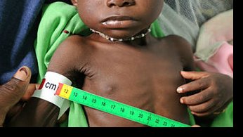 The Union Zimbabwe Trust (UZT) (@unionzimtrust) on Twitter photo <a href="/StopTB/">Stop TB Partnership</a> <a href="/drkav8/">fungai kavenga</a> <a href="/ntpzim/">ntpzim</a> <a href="/StopTBZimbabwe/">Stop TB Partnership Zimbabwe</a> <a href="/MoHCCZim/">Ministry of HealthZW</a> <a href="/healthtimeszim/">ππππ₯ππ‘ ππ’π¦ππ¬</a> <a href="/TheZimbabwean/">thezimbabwean</a> <a href="/UnionZimTrust/">The Union Zimbabwe Trust (UZT)</a> Technical Director <a href="/ItsSteeTime/">Dr Stee</a> introducing the project to the participants highlights that #malnutrition, a driver of childhood #TB with stunting and wasting in under 5s as high as 24% in #Zimbabwe (2022) <a href="/StopTB/">Stop TB Partnership</a> <a href="/drkav8/">fungai kavenga</a> <a href="/ntpzim/">ntpzim</a> <a href="/StopTBZimbabwe/">Stop TB Partnership Zimbabwe</a> <a href="/MoHCCZim/">Ministry of HealthZW</a> <a href="/healthtimeszim/">ππππ₯ππ‘ ππ’π¦ππ¬</a> <a href="/TheZimbabwean/">thezimbabwean</a> <a href="/UnionZimTrust/">The Union Zimbabwe Trust (UZT)</a> Technical Director <a href="/ItsSteeTime/">Dr Stee</a> introducing the project to the participants highlights that #malnutrition, a driver of childhood #TB with stunting and wasting in under 5s as high as 24% in #Zimbabwe (2022)