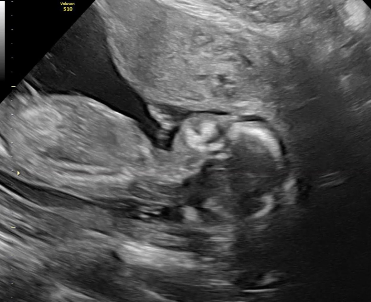 UncleGems tweet media