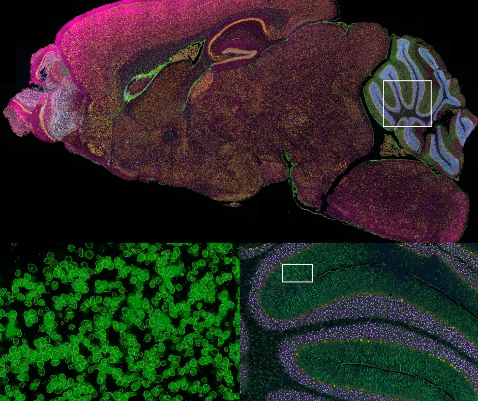 SA_genomics's tweet image. 🧠✨ Stunning image of a mouse sagittal brain section, captured with #Xenium 5K panel. Zoomed in on the cerebellum & hippocampus with incredible spatial resolution.
Looking for a 5K run partner? Connect with the @SA_genomics team to get started! #SpatialBiology