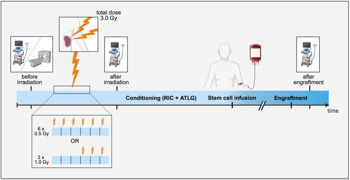 Nico Gagelmann (@nicogagelmann) on Twitter photo ๐Finally out๐
Our study showed value of low dose splenic irradiation and transplantation as part of a curative approach in myelofibrosis with refractory splenomegaly:
- significant spleen size reduction
- excellent engraftment
#mpnsm <a href="/ASTCT_Journal/">Transplantation and Cellular Therapy Journal</a>
astctjournal.org/article/S2666-โฆ ๐Finally out๐
Our study showed value of low dose splenic irradiation and transplantation as part of a curative approach in myelofibrosis with refractory splenomegaly:
- significant spleen size reduction
- excellent engraftment
#mpnsm <a href="/ASTCT_Journal/">Transplantation and Cellular Therapy Journal</a>
astctjournal.org/article/S2666-โฆ