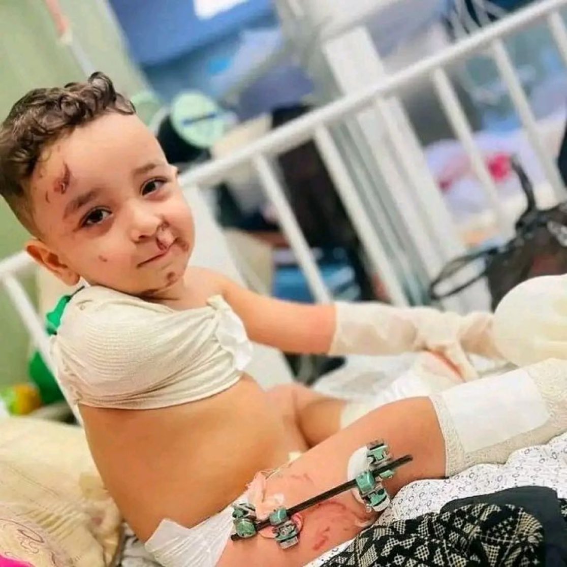 Ölen sadece insanlar değil,
Vicdan.
Ahlak.

Sessiz kalan medeniyetin maskesi.
Ama biz maskeleri düşürmeye geldik.

Çünkü sustukça ölüyoruz.
Çünkü unuttukça onlar kazanıyor.

#ExposeTheAtrocity #VahşetiİfşaEt