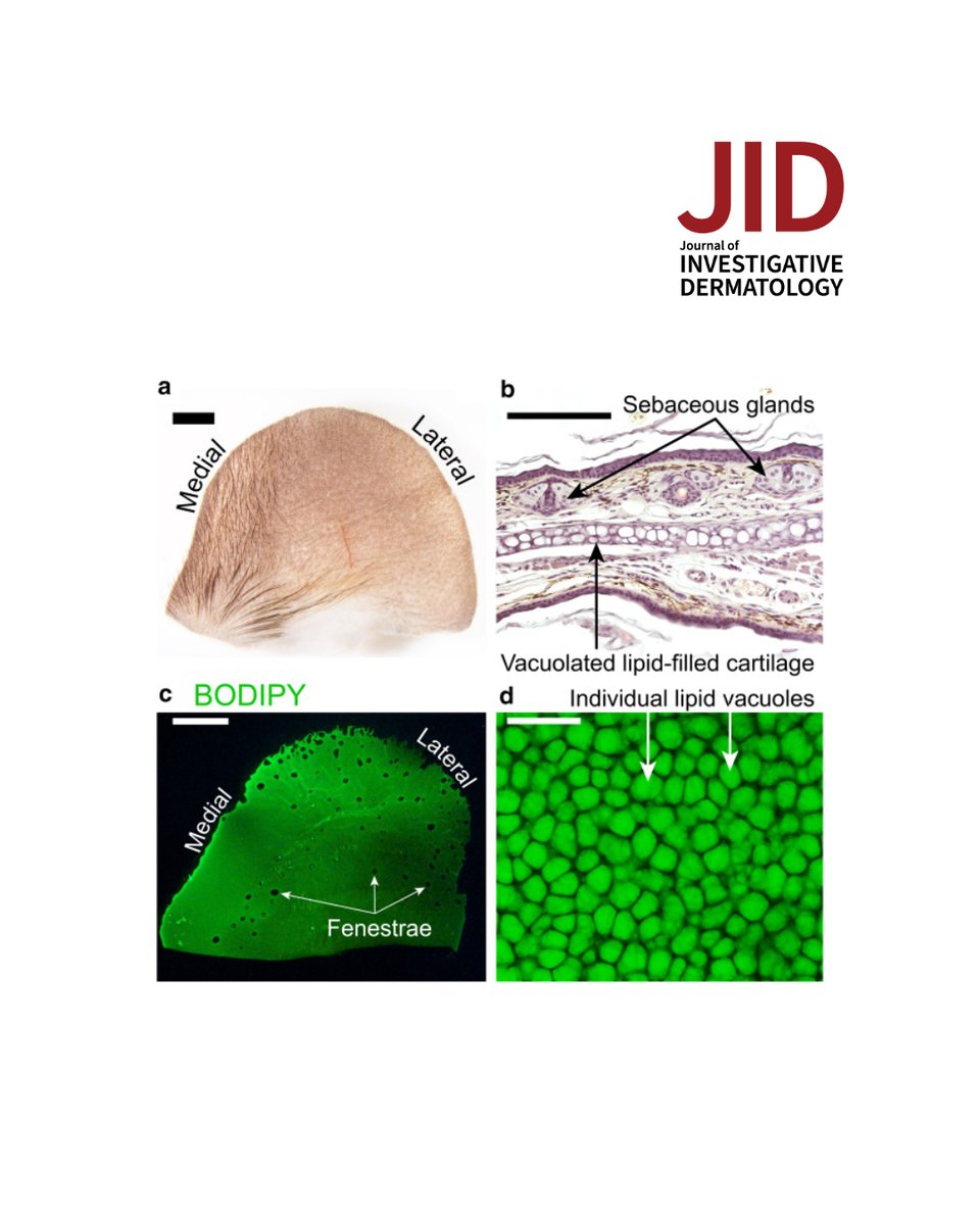 A News &amp; Perspectives article by Raul Ramos &amp; Maksim Plikus, "Skin-Associated Cartilage is a Distinct Type of Lipid-Filled Tissue" doi.org/10.1016/j.jid.… #JIDJournal #dermscience