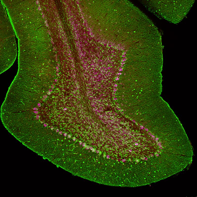 UAB is accelerating spatial biology with the new Lunaphore COMET platform! 🧬
Congrats to BME’s Dr. Juhi Samal, one of eight research team leads selected to launch projects using this cutting-edge tech.
🔬 uab.edu/news/research-…
@uabnews <a href="/uabmedicine/">UAB Medicine</a> @uabheersink <a href="/JuhiSamal/">Juhi Samal</a>