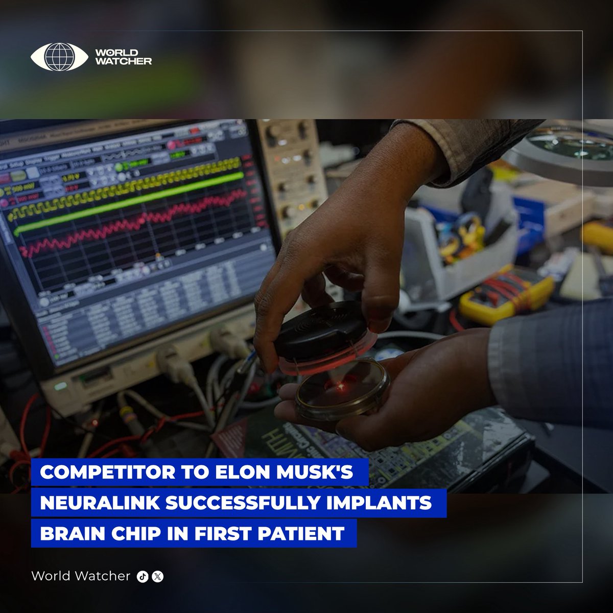 World__Watcher_'s tweet image. BREAKING: Paradromics, a competitor to Neuralink, has made headlines by successfully implanting its brain chip, Connexus, into its first patient during an epilepsy surgery! This breakthrough demonstrates potential for advanced brain-computer interactions. 

#BrainTech…