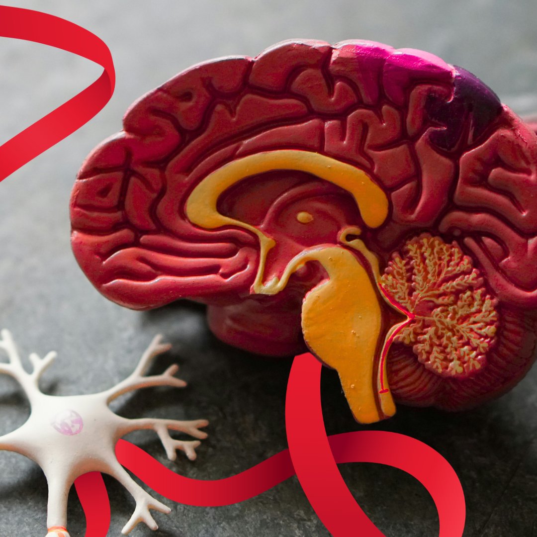 June is #BrainInjuryAwareness Month in Canada! 🧠

This month is dedicated to raising awareness, reducing stigma, and supporting those living with brain injuries, as well as the caregivers who support them.

To learn more about brain injuries: braininjurycanada.ca/en/