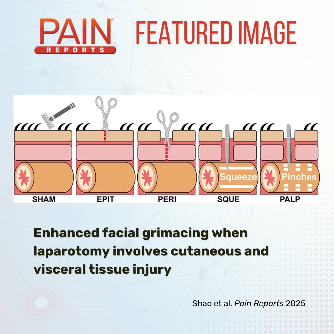 IASP (@iasppain) on Twitter photo <a href="/MarkZylka/">Mark Zylka</a> et al. find that facial grimacing in mice is more pronounced when cutaneous and visceral tissues are injured during laparotomy surgery compared to cutaneous injury alone. Learn more in #PainReports bit.ly/4kyDQ4G <a href="/MarkZylka/">Mark Zylka</a> et al. find that facial grimacing in mice is more pronounced when cutaneous and visceral tissues are injured during laparotomy surgery compared to cutaneous injury alone. Learn more in #PainReports bit.ly/4kyDQ4G