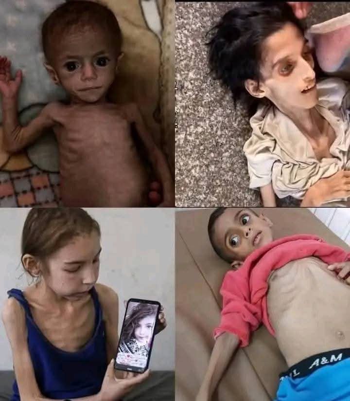 We are still starving.