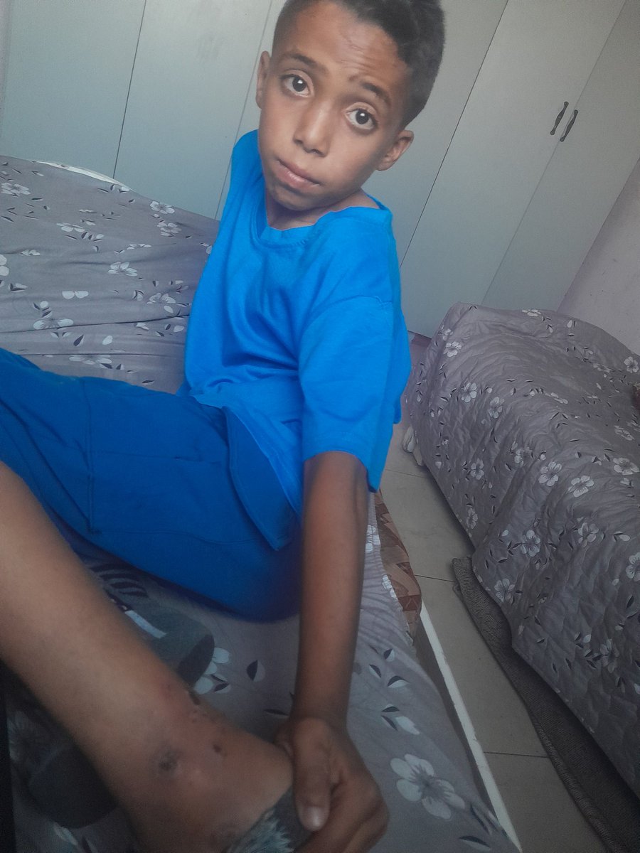 WfaMtr64836's tweet image. I am Wafaa, a sick person and the breadwinner for my family after losing my husband and my son Waseem. Waseem has an enlarged liver and needs treatment. He needs your donations. Please help me. chuffed.org/project/126993…