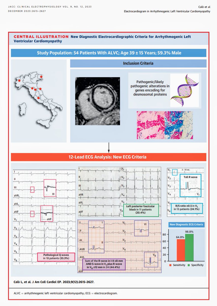 🟢 12-Lead ECG in Arrhythmogenic Left Ventricular Cardiomyopathy 🟢
Low sensitivity. High specificity.
pubmed.ncbi.nlm.nih.gov/37768253/
