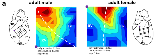 AJP-Heart and Circ (@ajpheartcirc) on Twitter photo An equally large and talented team from <a href="/unipr/">Università di Parma</a> bring you today's #ArticleinPress, Sex-specific #cardiac electrophysiological remodeling influences the susceptibility to #arrhythmias in elderly rats (Rosario Statello et al.):
ow.ly/zva450W3wZ5 An equally large and talented team from <a href="/unipr/">Università di Parma</a> bring you today's #ArticleinPress, Sex-specific #cardiac electrophysiological remodeling influences the susceptibility to #arrhythmias in elderly rats (Rosario Statello et al.):
ow.ly/zva450W3wZ5