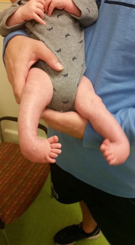 CoachMBurris's tweet photo. June 3rd is always a special day in our house! #worldclubfootday Grateful for all the care Braxten received early in his life from @shrinershosp https://t.co/WTOg5UgJqf