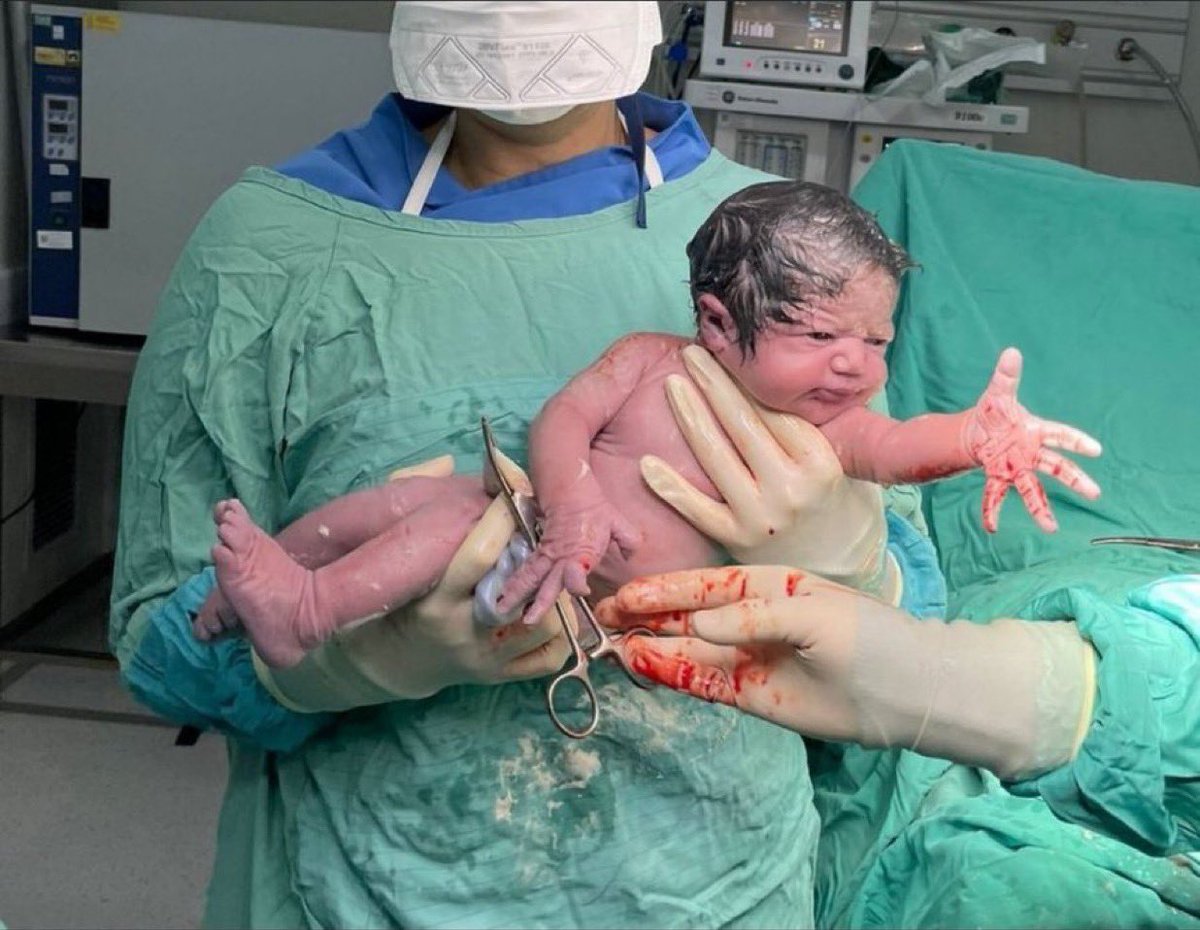 Bugün, Adana Şehir Hastanesi'nde Adana’da doğduğunu öğrenen erkek bebeğin sinirli tavırları dikkat çekti.