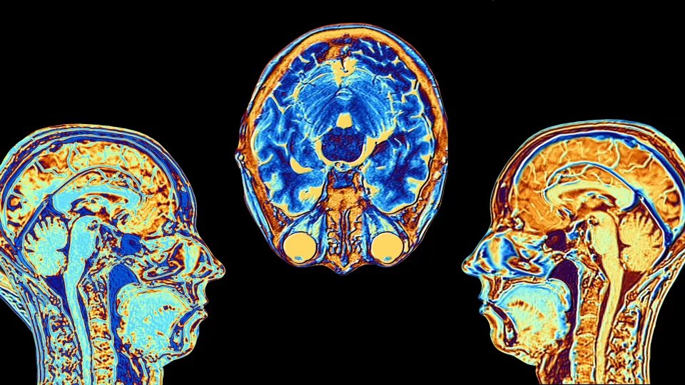 Keck School of Medicine of USC (@keckschool_usc) on Twitter photo Researchers at <a href="/ChildrensLA/">Children's Hospital LA</a> tested a new (fMRI) analysis method to measure cerebrovascular health in aging adults.
Surprising results confirm this method’s value in tracking neurovascular aging in childhood diseases.
🔗 bit.ly/451ExyU Researchers at <a href="/ChildrensLA/">Children's Hospital LA</a> tested a new (fMRI) analysis method to measure cerebrovascular health in aging adults.
Surprising results confirm this method’s value in tracking neurovascular aging in childhood diseases.
🔗 bit.ly/451ExyU
