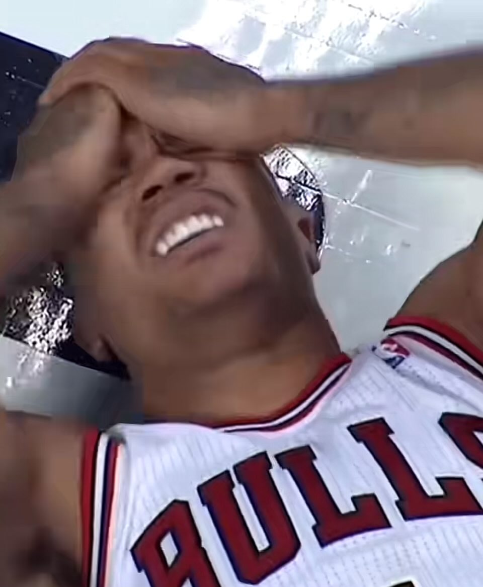 Sprained my finger hooping