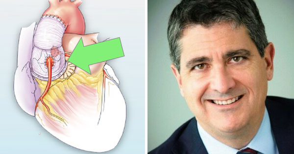 Adam Pick (@heart_valve) on Twitter photo Surgeon Q&A: Why is <a href="/EricRoselliMD/">Eric E. Roselli</a> at the <a href="/ClevelandClinic/">Cleveland Clinic</a> using the novel BeSPoKE procedure to help heart valve patients struggling with patient prosthesis mismatch? Get the answer at heart-valve-surgery.com/learning/bespo…. #CardiacSurgery #Innovation Surgeon Q&A: Why is <a href="/EricRoselliMD/">Eric E. Roselli</a> at the <a href="/ClevelandClinic/">Cleveland Clinic</a> using the novel BeSPoKE procedure to help heart valve patients struggling with patient prosthesis mismatch? Get the answer at heart-valve-surgery.com/learning/bespo…. #CardiacSurgery #Innovation