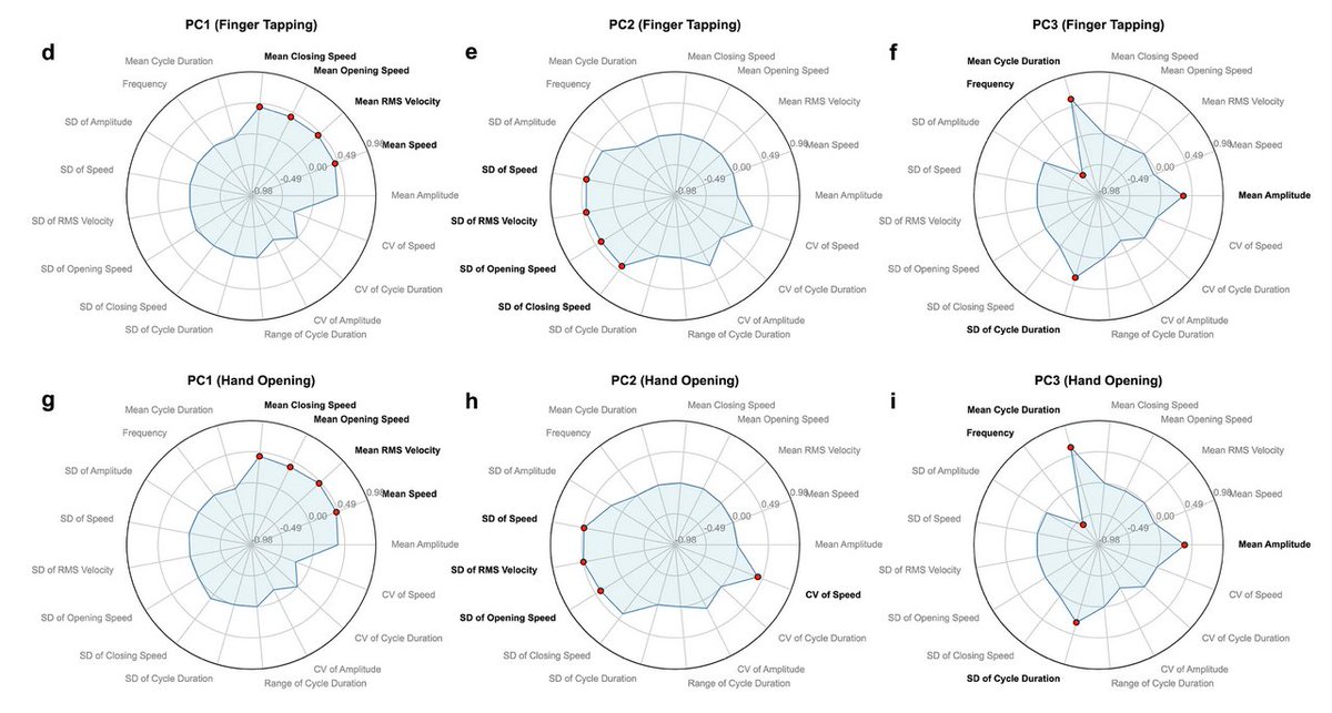 Joshua Wong (@jwongggmd) on Twitter photo Great paper by Florian Lange using VisionMD.ai to uncover 3 novel kinematic domains of bradykinesia. Look at these distinct profiles in response to levodopa. Much more detail than "decrement" or "hesitation"! <a href="/Nature_NPJ/">npj Journals</a>
nature.com/articles/s4153… Great paper by Florian Lange using VisionMD.ai to uncover 3 novel kinematic domains of bradykinesia. Look at these distinct profiles in response to levodopa. Much more detail than "decrement" or "hesitation"! <a href="/Nature_NPJ/">npj Journals</a>
nature.com/articles/s4153…