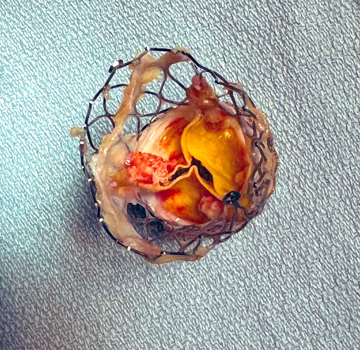 Stephane Leung, MD MSc FRCSC tweet media