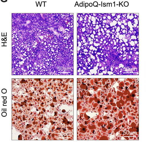SvenssonLab (@svenssonlab) on Twitter photo Happy to share our latest paper showing that deletion of adipose-derived Isthmin-1 leads to fatty liver and elevated ceramides. Congrats to first author Saranya Reghupaty and all the co-authors! <a href="/MolMetab/">Molecular Metabolism</a> <a href="/StanfordPath/">Stanford Pathology</a> <a href="/StanfordDRC/">Stanford Diabetes Research</a> sciencedirect.com/science/articl… Happy to share our latest paper showing that deletion of adipose-derived Isthmin-1 leads to fatty liver and elevated ceramides. Congrats to first author Saranya Reghupaty and all the co-authors! <a href="/MolMetab/">Molecular Metabolism</a> <a href="/StanfordPath/">Stanford Pathology</a> <a href="/StanfordDRC/">Stanford Diabetes Research</a> sciencedirect.com/science/articl…