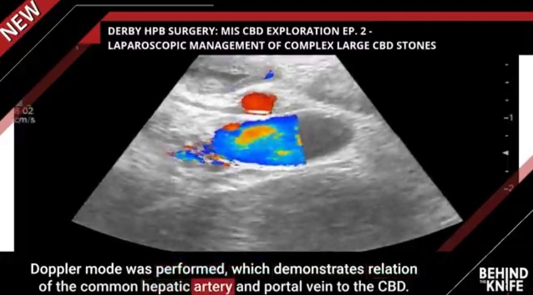 Derby Pancreaticobiliary & Robotic AWR Unit tweet media
