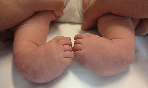 En el día mundial del #piebot presentamos una ley de concientización, visibilización y fortalecimiento que atienda a las infancias que padecen esta patología. 

Junto a <a href="/paobenitezchaco/">Paola Benítez</a> seguimos proponiendo leyes sanitarias que atiendan las demandas de las familias chaqueñas 🏥❤️