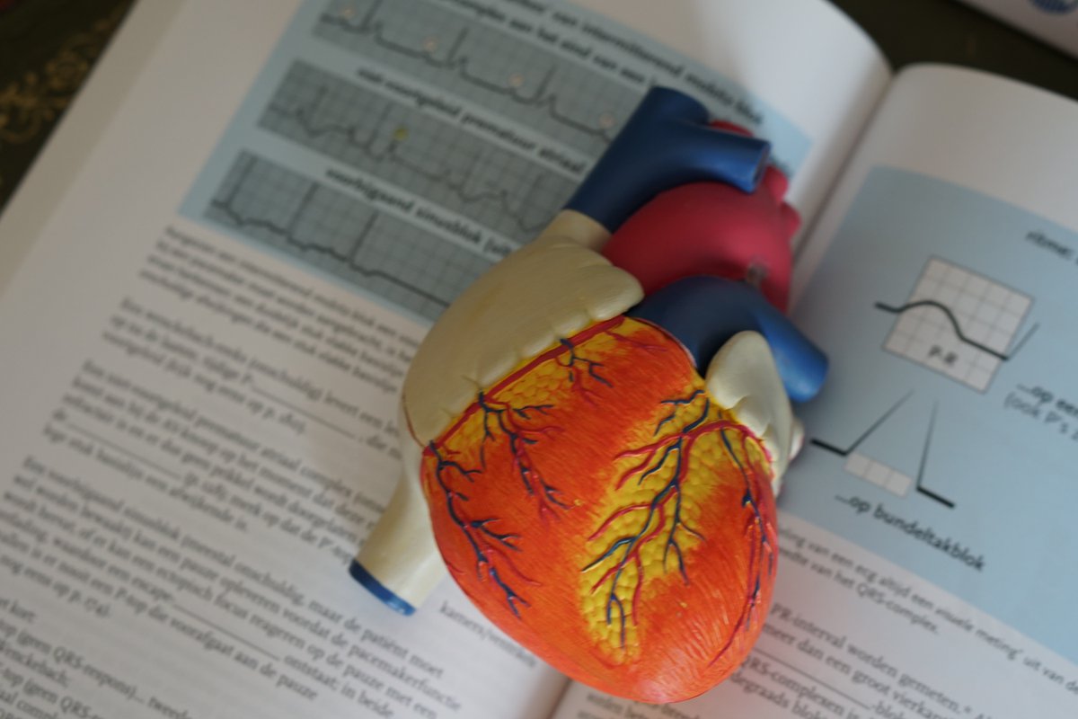 A research group from Sun Yat-sen University show a previously unrecognized role of NETs and CCDC25 in anthracycline #cardiotoxicity.

They suggest that targeting CCDC25 could provide a dual therapeutic and cardioprotective advantage. 🫀

<a href="/NatureCancer/">Nature Cancer</a> | go.nature.com/3ZL41Nq
