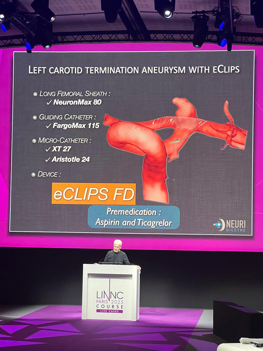EvascMed's tweet photo. Evasc wishes to thank Laurent Spelle for a masterful job delivering the eCLIPs bifurcation flow diverter, eBFD, into a perfect position; and congratulate Jacques Moret and Vitor Pereira on narrating the nuances of eCLIPs use. And to all 3 for a most instructive LINNC meeting. https://t.co/2YcUMZEtvG