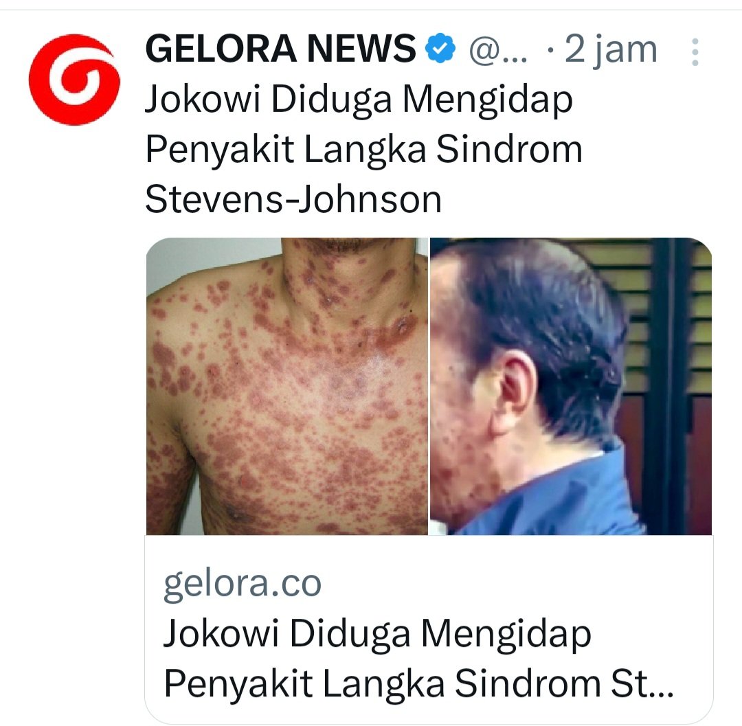 Bongoh tweet media