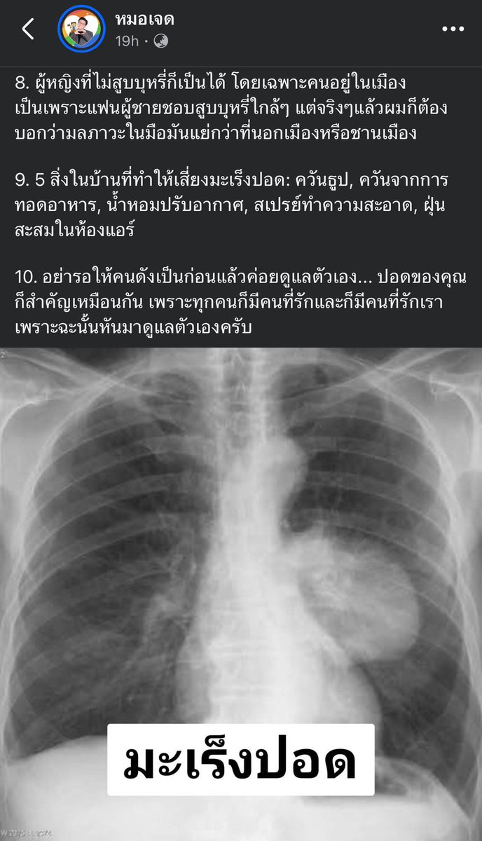 10 เรื่องที่ควรรู้เกี่ยวกับมะเร็งปอด
จากเพจ หมอเจด
