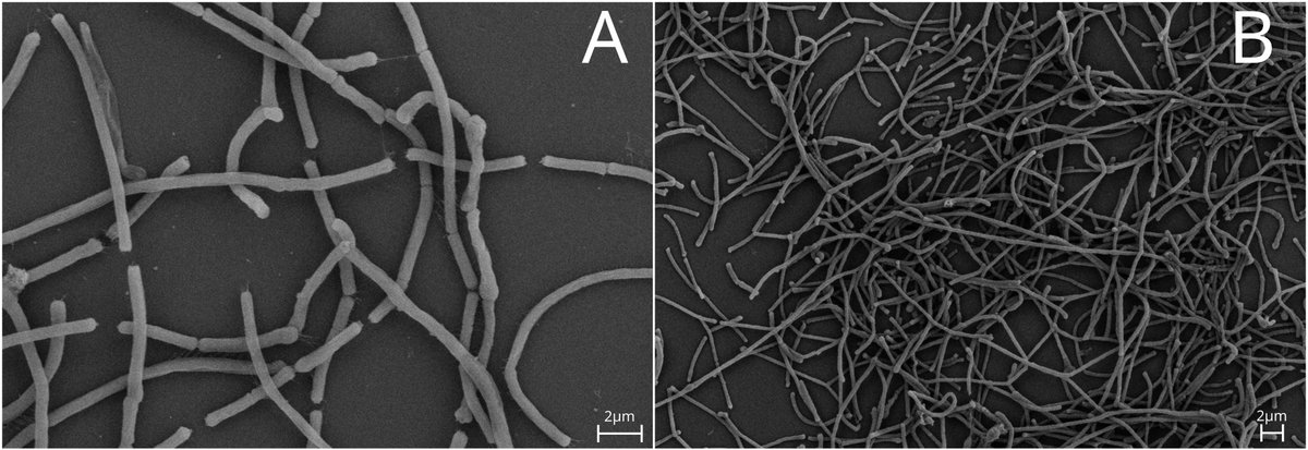 Liviana (@livi_ricci) on Twitter photo 🦠NEW HUMAN GUT SUBSPECIES ALERT🦠
Meet Catenibacterium mitsuokai subsp. tridentinum - named after Trento, Italy - home of <a href="/cibiocm/">Segata Lab</a> !
Highly prevalent in non-urbanized guts🌾
Produces acetate - a key gut metabolite
For more details: doi.org/10.1099/ijsem.… #IJSEM <a href="/MicrobioSoc/">Microbiology Society</a> 🦠NEW HUMAN GUT SUBSPECIES ALERT🦠
Meet Catenibacterium mitsuokai subsp. tridentinum - named after Trento, Italy - home of <a href="/cibiocm/">Segata Lab</a> !
Highly prevalent in non-urbanized guts🌾
Produces acetate - a key gut metabolite
For more details: doi.org/10.1099/ijsem.… #IJSEM <a href="/MicrobioSoc/">Microbiology Society</a>