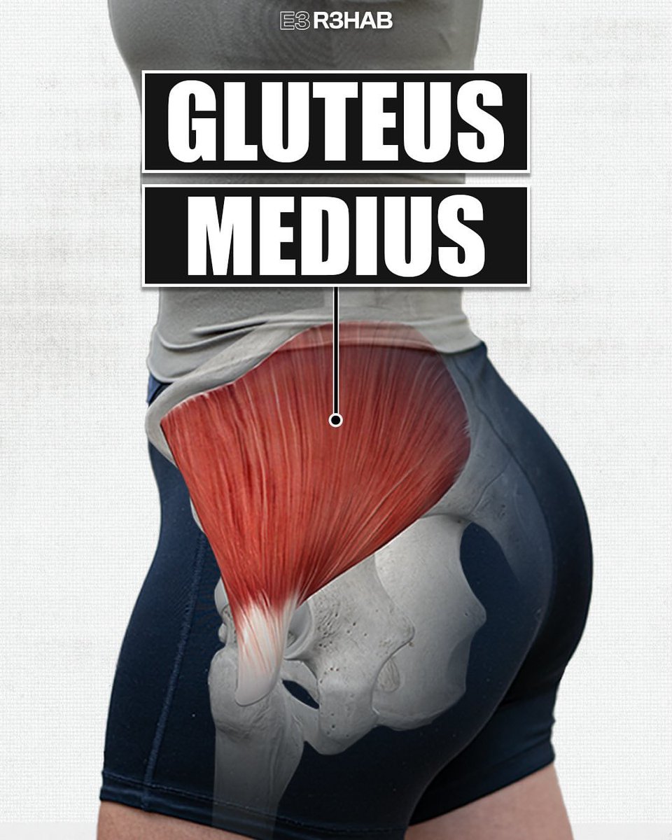 Exercises targeting the gluteus medius should likely involve direct hip abduction or include a component of having to control and stabilize the pelvis in weight bearing.

Shown are a handful of options that can be used for training or rehab purposes.

🧵