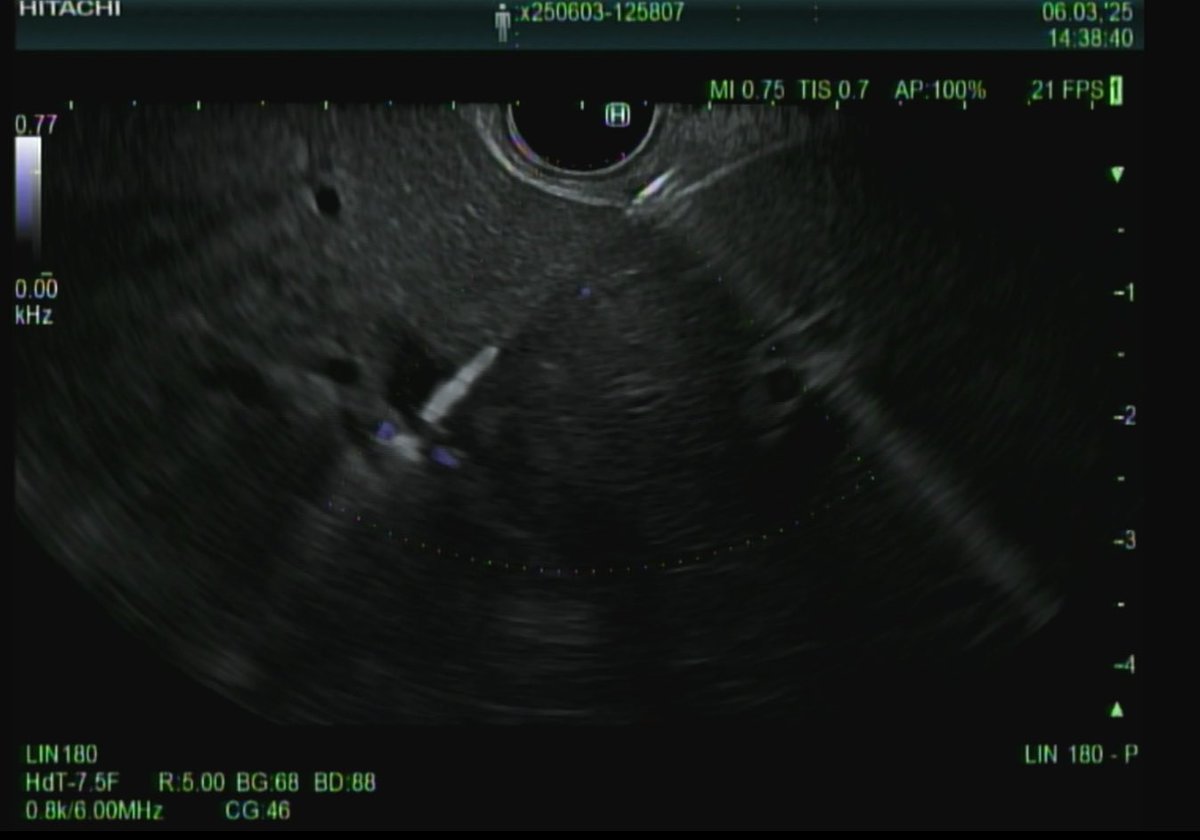 Vishnu Kumar tweet media