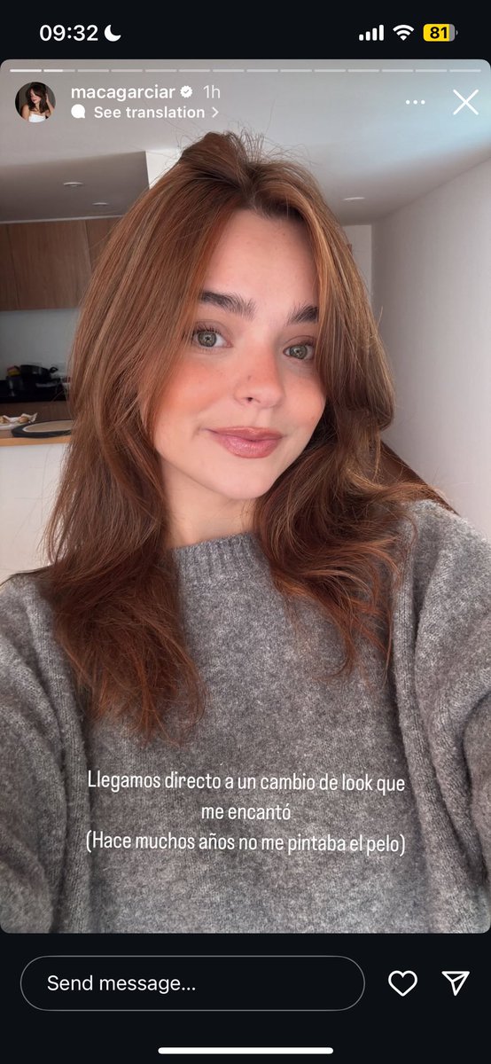 prioritymaca's tweet image. que linda que estaaaaa