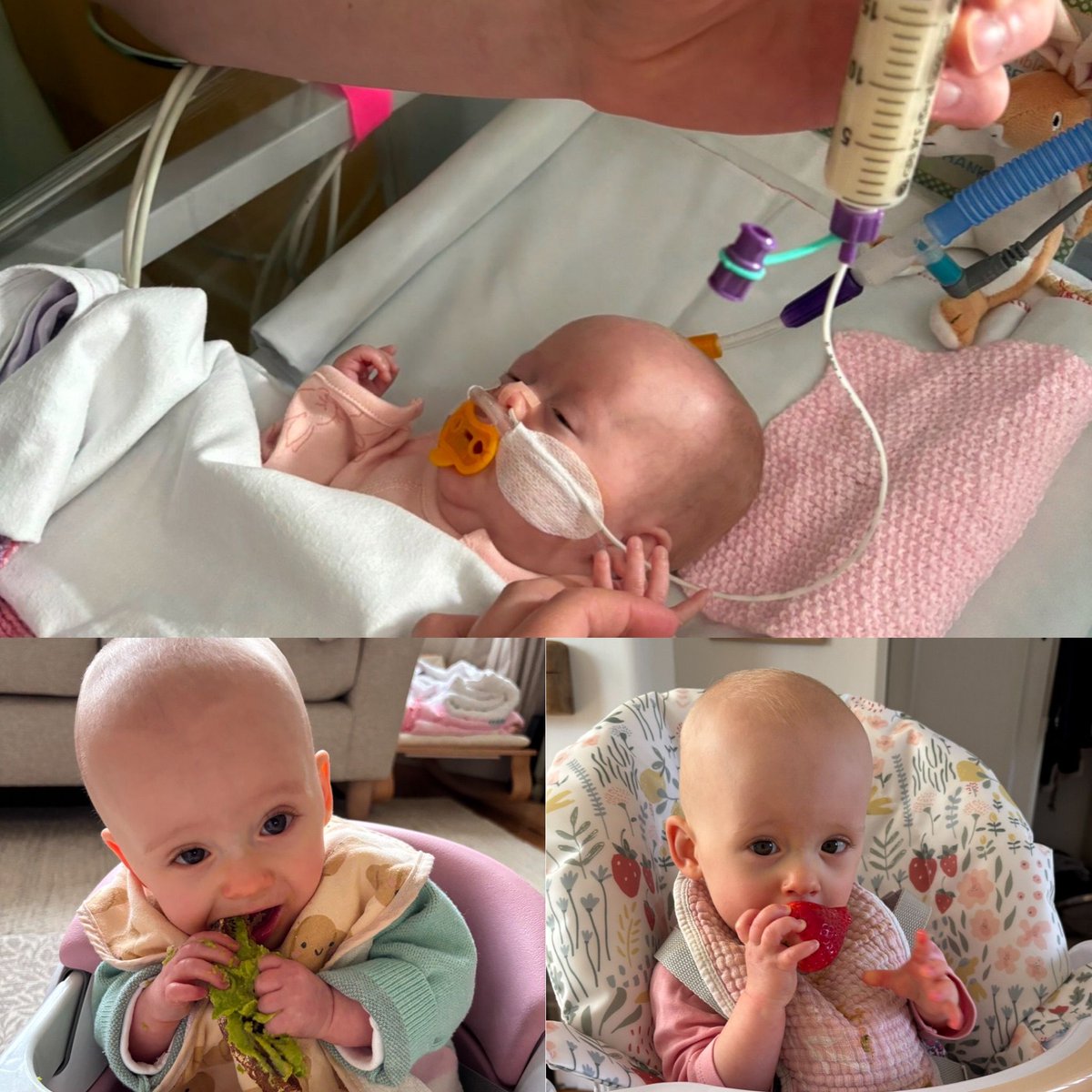 NW Neonatal ODN (@nwneonatalodn) on Twitter photo To the dietitians who cared for Vienna—thank you. 💛 From NICU to home, through bottle aversion and weaning stress, your support has meant everything. Feeding isn’t just nutrition—it’s connection, compassion, and growth. <a href="/BDA_Dietitians/">British Dietetic Association</a> #NeonatalDietitiansWeek To the dietitians who cared for Vienna—thank you. 💛 From NICU to home, through bottle aversion and weaning stress, your support has meant everything. Feeding isn’t just nutrition—it’s connection, compassion, and growth. <a href="/BDA_Dietitians/">British Dietetic Association</a> #NeonatalDietitiansWeek