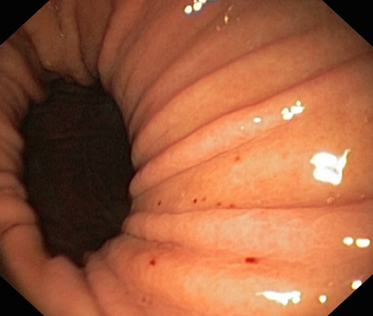 EndoCollab™ | GI Endoscopy Community tweet media