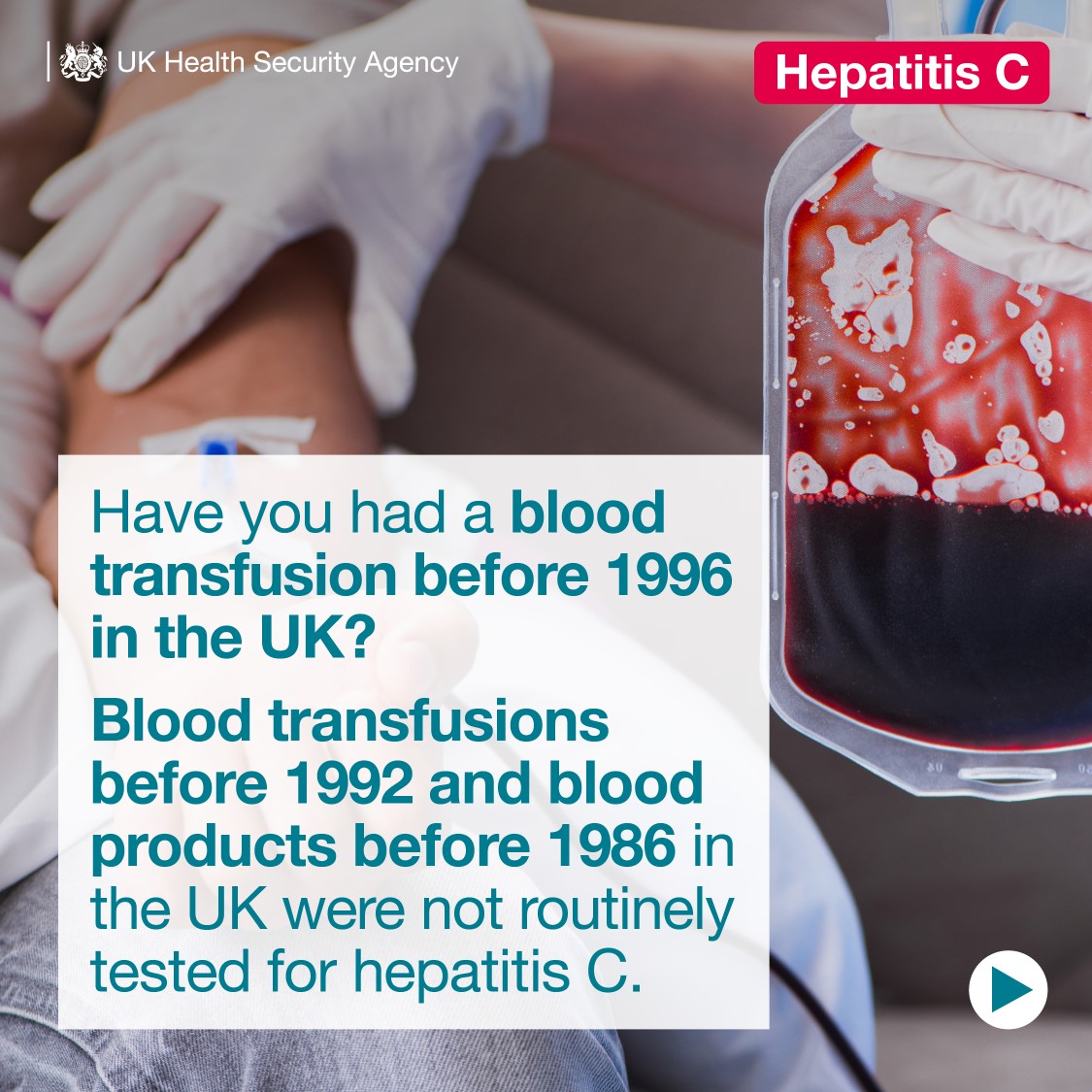 Many people who have hepatitis are unaware they have the infection, because the viruses can be symptomless. This means they aren’t getting the treatments they need and are possibly passing the virus on.

Take action now by getting your at home test kit ➡️ orlo.uk/AvWKR