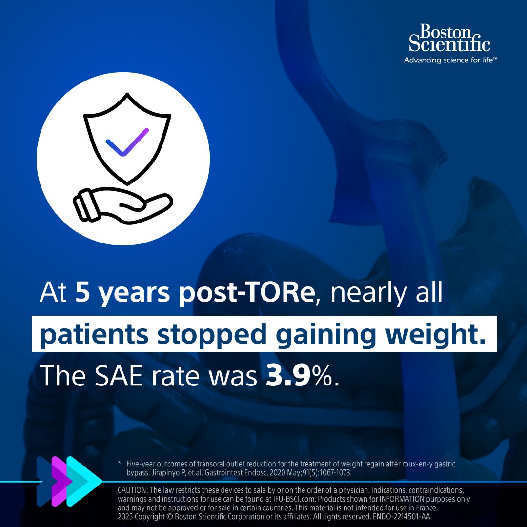 🔍 Key findings from "Five-year outcomes of transoral outlet reduction for weight regain after roux-en-y gastric bypass": at 5 years post-TORe, nearly all patients stopped gaining weight, SAE rate was 3.9%. 

Learn more: bit.ly/43QTYb1

#BSCEMEA #Endobariatrics