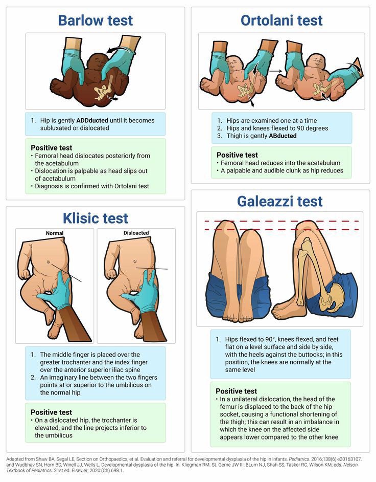 OnSquares's tweet image. Summary of Hip Dysplasia Examination 

#Pediatric #Neonatology #Orthopedic 🦴