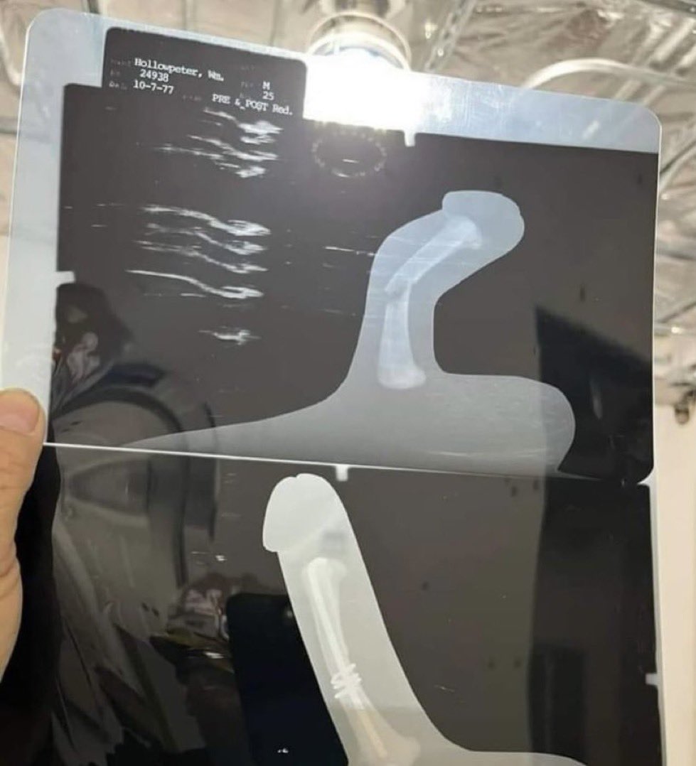 MrTestoestrogen tweet media