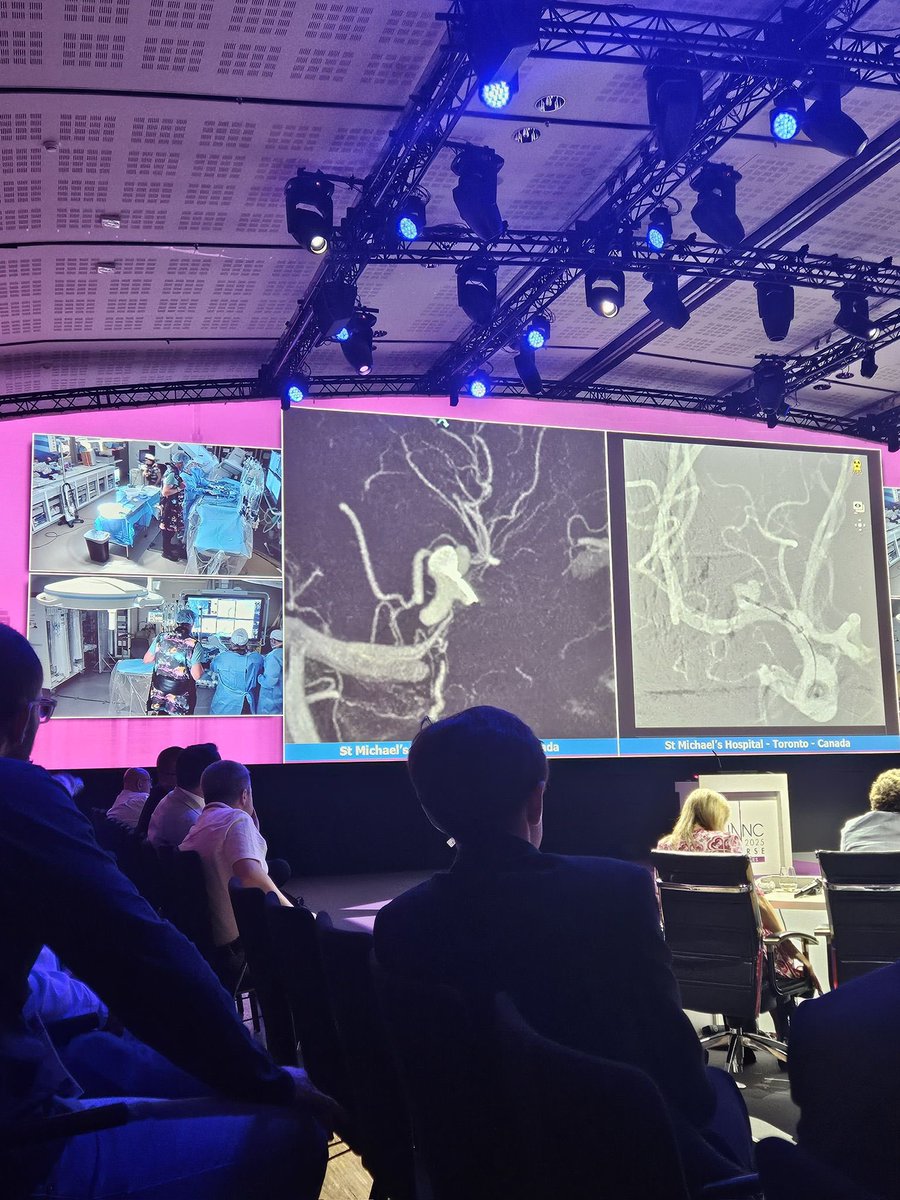 Dr. DiestroKE (@dannidiestro) on Twitter photo Did my first live cases as primary operator for #LINNC2025 <a href="/LINNConline/">LINNC online 🧠</a> yesterday <a href="/SmhNeuroVasc/">Neurovascular Center @ St. Michael's Hospital</a> 🇨🇦 with boss <a href="/vitorpereiracan/">Vitor Mendes Pereira</a> moderating in Paris 🇫🇷 ! What a rush! Would not have been possible without the support of <a href="/NMCancelliere/">Nicole Cancelliere</a> <a href="/trmarot/">Tom Marotta</a> our fellows, nurses and techs onsite! 🚀 Did my first live cases as primary operator for #LINNC2025 <a href="/LINNConline/">LINNC online 🧠</a> yesterday <a href="/SmhNeuroVasc/">Neurovascular Center @ St. Michael's Hospital</a> 🇨🇦 with boss <a href="/vitorpereiracan/">Vitor Mendes Pereira</a> moderating in Paris 🇫🇷 ! What a rush! Would not have been possible without the support of <a href="/NMCancelliere/">Nicole Cancelliere</a> <a href="/trmarot/">Tom Marotta</a> our fellows, nurses and techs onsite! 🚀