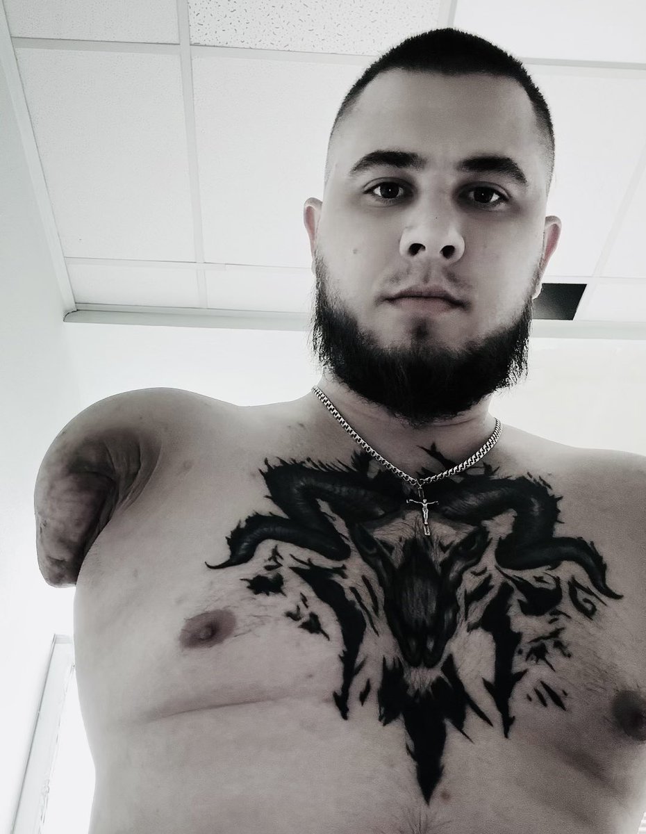 vlad_beseda's tweet image. ‼️Прошу максимально поширити ‼️

Денис Петлюк втратив руку виконуючи бойові завдання на Курщині. Денис потребую дороговартісної операції.

Сьогодні Денису зробили вже першу операцію. Кошти потрібні дуже терміново. 

Реквізити:
send.monobank.ua/jar/2EkggF4Q5Q

PayPal:…