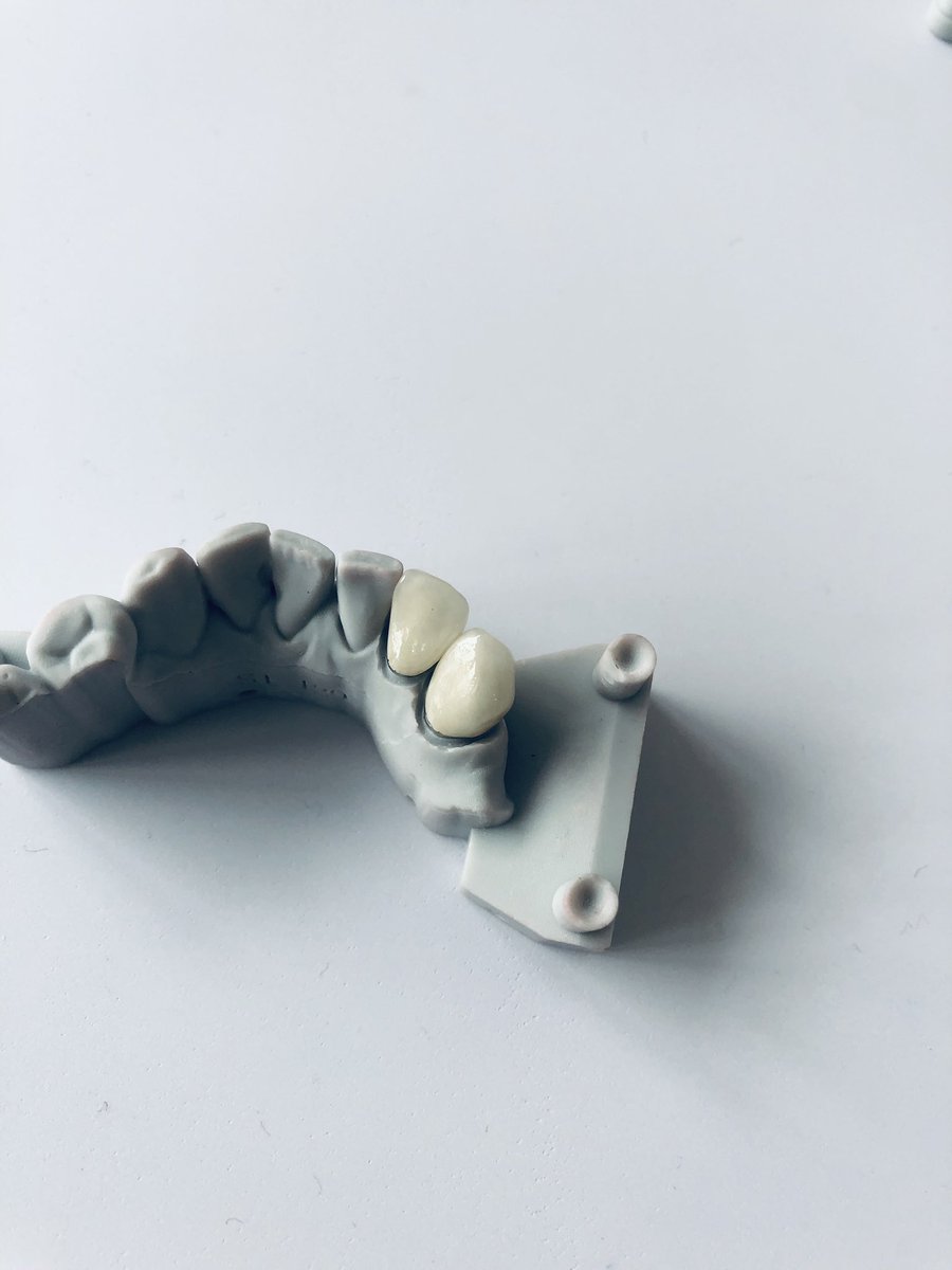 SZDiamonddental's tweet image. FMC crown&amp;amp;PFM crown#dental #fixedteeth #dentallab
