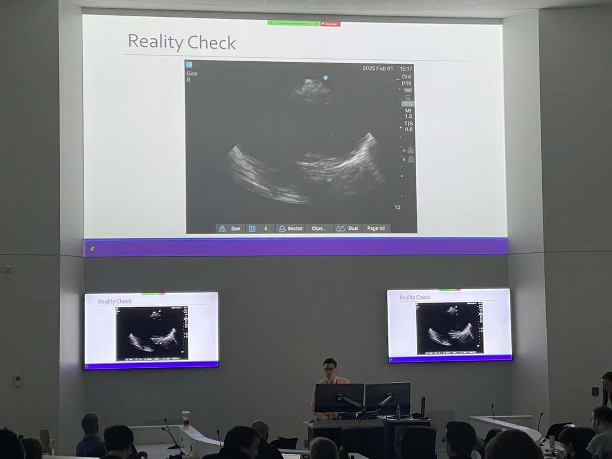 Andrew Higgins (@andrewhigginsmd) on Twitter photo Stunned every year at the growth in this conference and our field - CCCES 2025 off to an excellent start with a packed morning of laryngoscopy, chest tube, bronch, cric/trach followed by a pivot to TEE guided resuscitation with 🍑 Sam Bernard <a href="/UMN_CCCEdSummit/">UMN Critical Care Cardiology Education Summit</a> <a href="/AndreaElliottUM/">Andrea Elliott</a> Stunned every year at the growth in this conference and our field - CCCES 2025 off to an excellent start with a packed morning of laryngoscopy, chest tube, bronch, cric/trach followed by a pivot to TEE guided resuscitation with 🍑 Sam Bernard <a href="/UMN_CCCEdSummit/">UMN Critical Care Cardiology Education Summit</a> <a href="/AndreaElliottUM/">Andrea Elliott</a>
